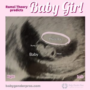 Ramzi Theory Girl Example Image 3