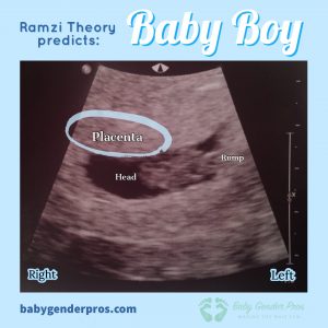 Ramzi Theory Example Boy Image 3