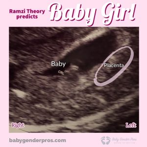 Ramzi Theory Girl Example Image 3