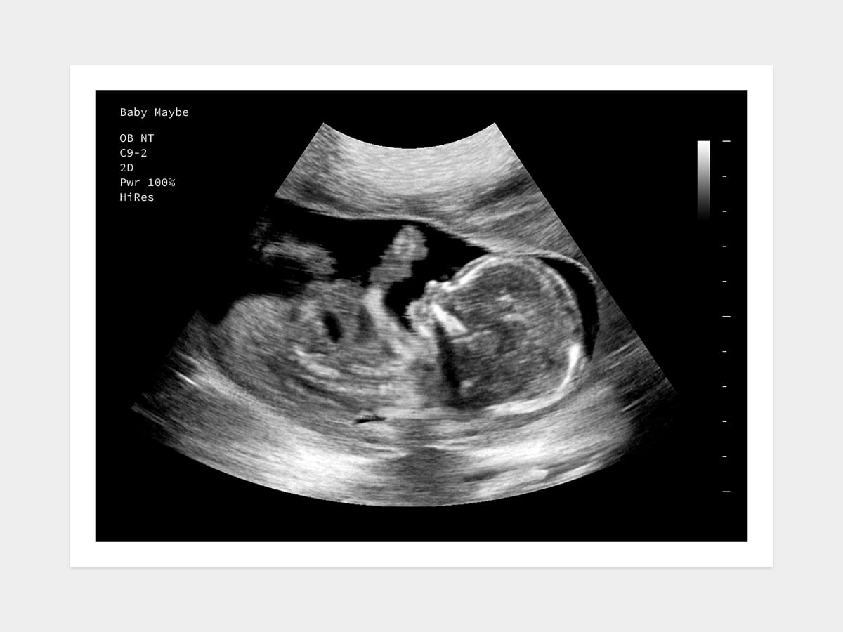 16 Week Ultrasound Boy