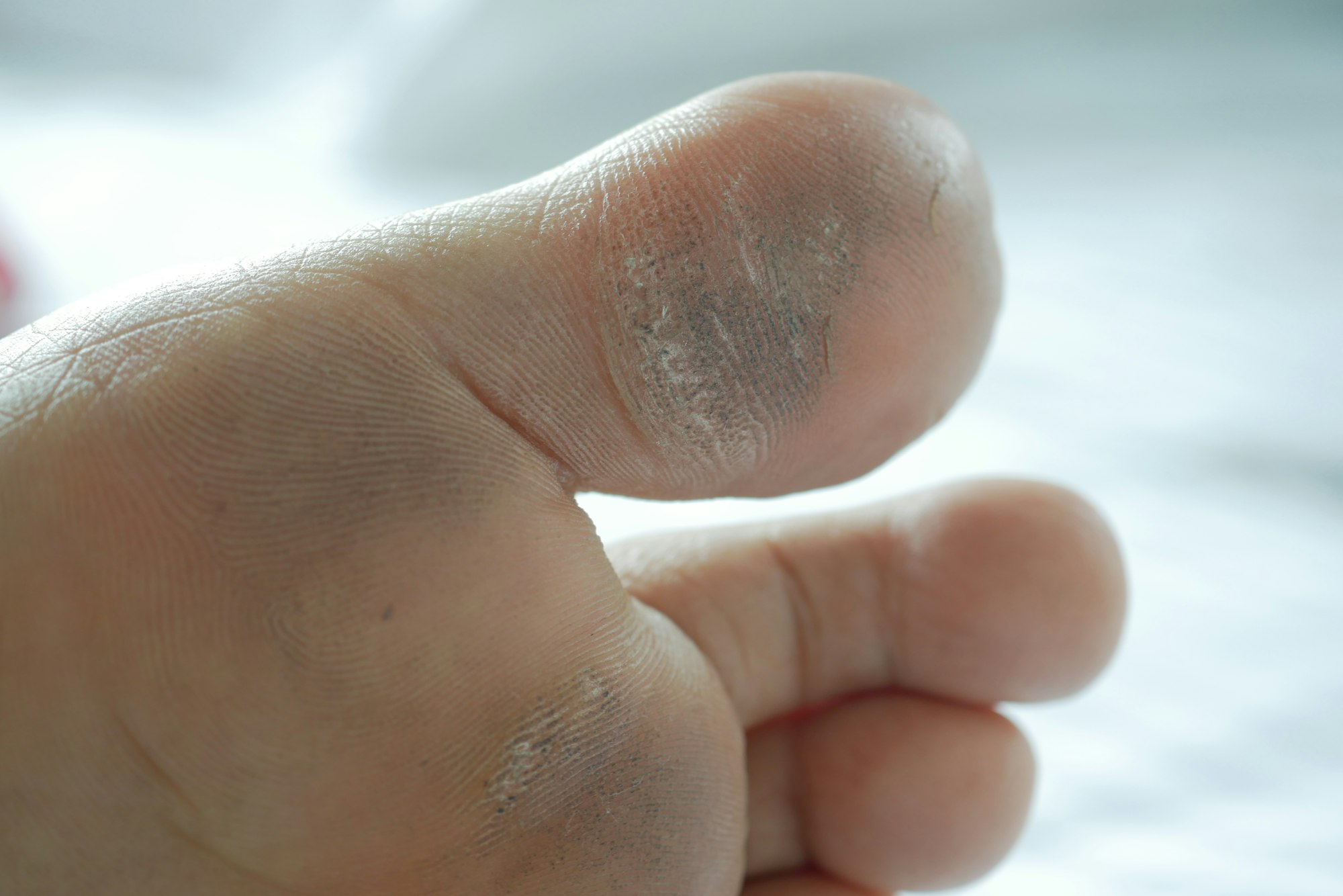 close up of young men dry feet on bed ,