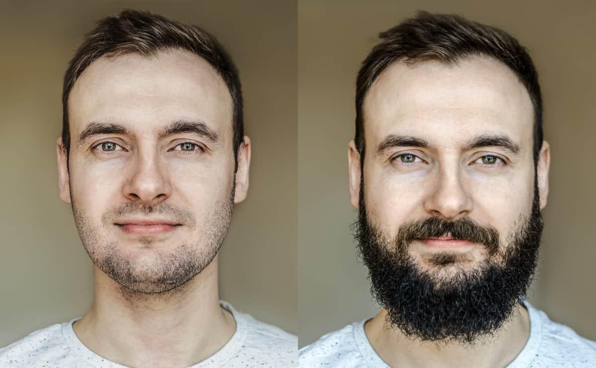 6 Reasons 'Why Can't I Grow a Beard' plus Growth Tips - Bald & Beards