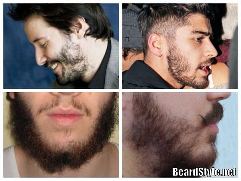 Weak Beard Growth