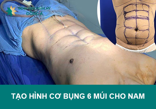 Tạo hình cơ bụng 6 múi cho nam không cần tập gym vất vả