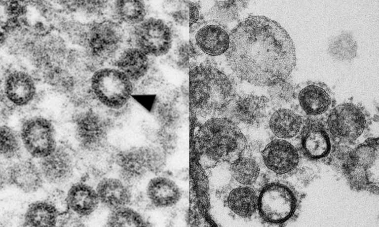 Corona Virus