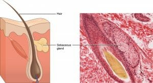 Sebaceous Glands