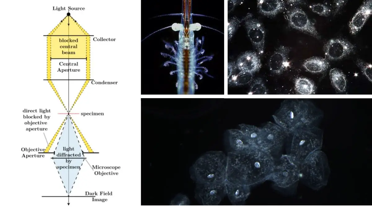 Dark Field Microscopy - Principle, Parts, Procedure, Uses