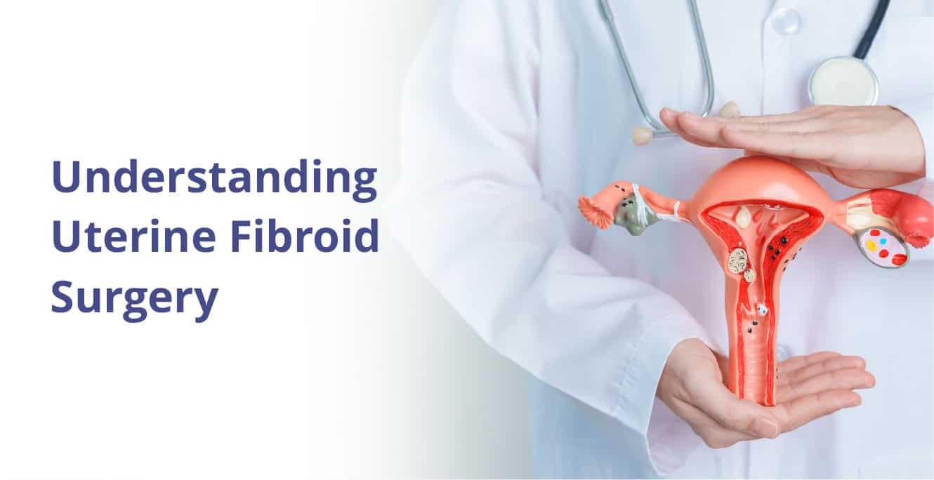 Understanding the Impact of Uterine Fibroid Surgery on Fertility ...