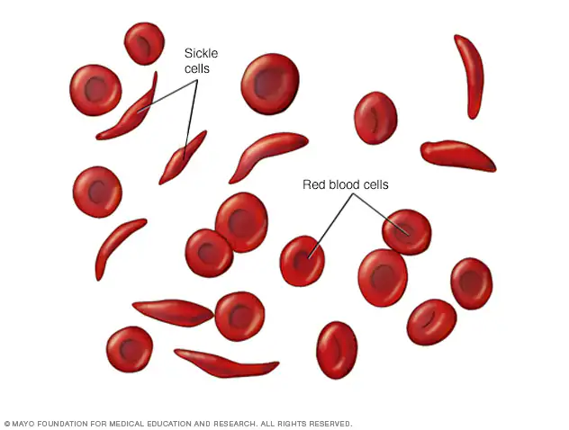 The FDA approves the first two cell-based gene therapies to cure the ...