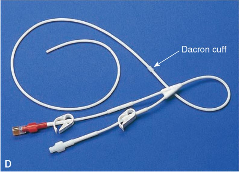 Tunneled Central Venous Catheter