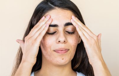 a woman applying skincare products on her face