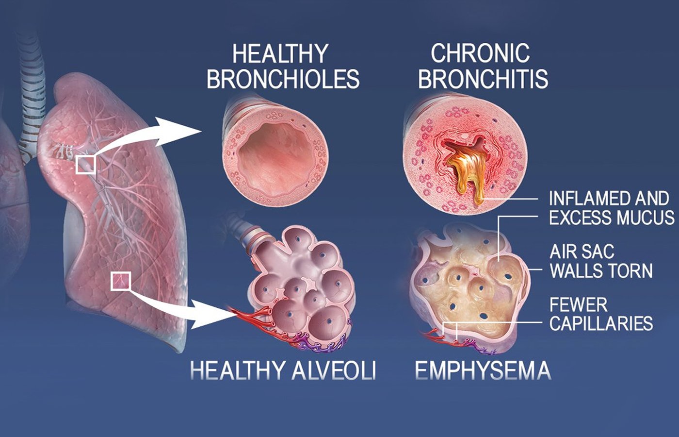 Human Respiratory System - Blog | Stuid Learning App