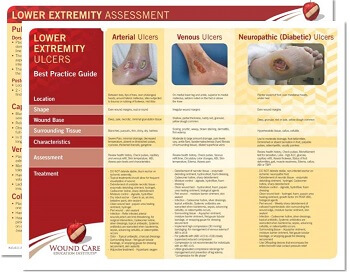 Open sores (ischemic ulcers) on the lower extremities - Pictures