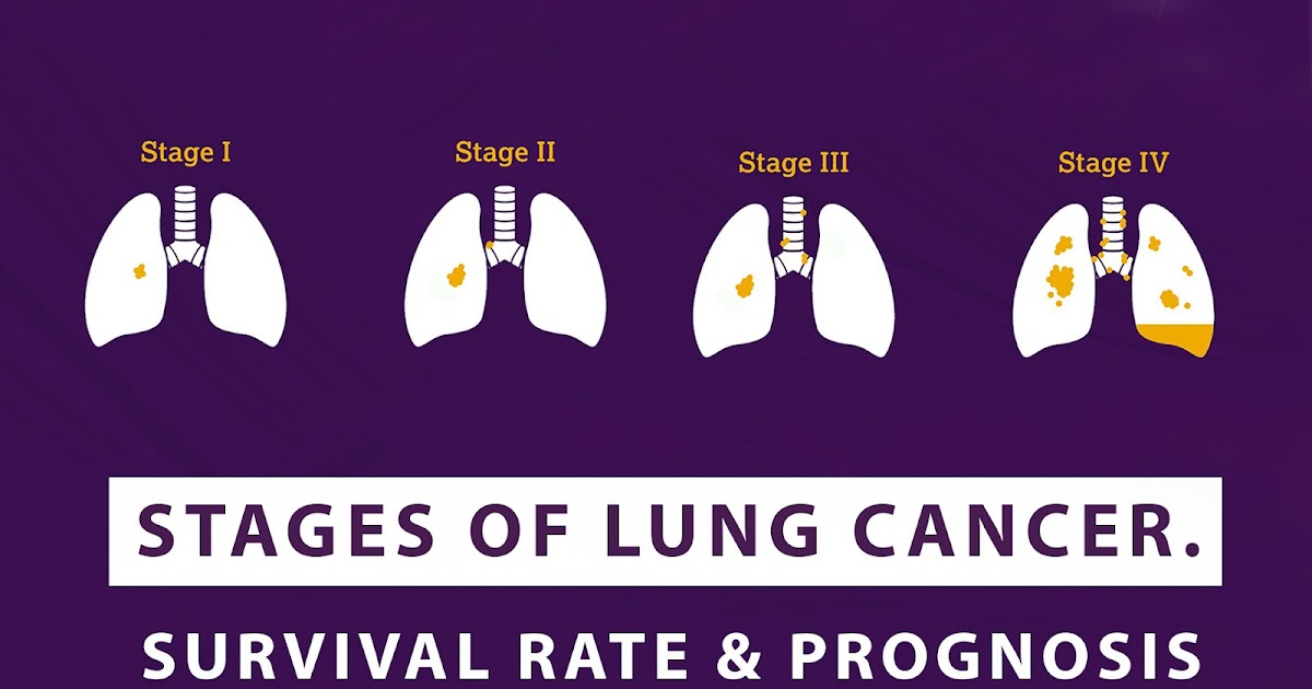 What are neuroendocrine tumors, and how are they treated?