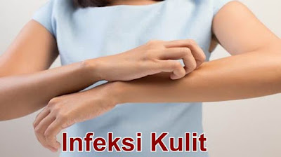 http://maulherbal.blogspot.co.id/2017/06/pengobatan-alami-untuk-infeksi-kulit.html