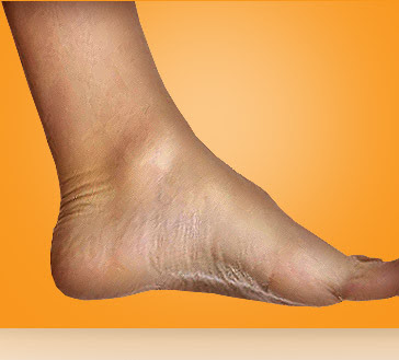 ankle pain