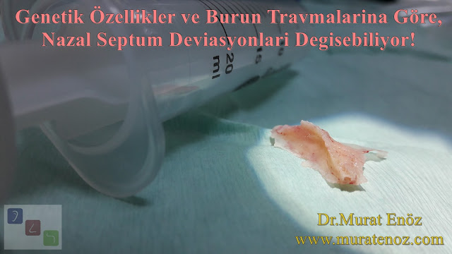 azal Septum Deviasyonu Çeşitleri - Nazal Septum Deviasyonu Animasyonu - Kaudal Septum Deviasyonu - Anterior Septal Dislokasyon - Kaudal Septoplasti - Kaudal Septum Deviasyonu Tedavisi - Septal Spur Formasyonu - Nazal Septal Spur - Burunda Kemik Spur - Septal Spur Belirtileri - Septal Spur Tedavisi - Nazal Septum Deviasyonu Tedavisi - Deviasyon Ameliyatı Nasıl Yapılır? - Septoplasti Ameliyatı - SMR Ameliyatı