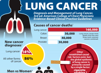 17 Key Lung Cancer Demographics - BrandonGaille.com