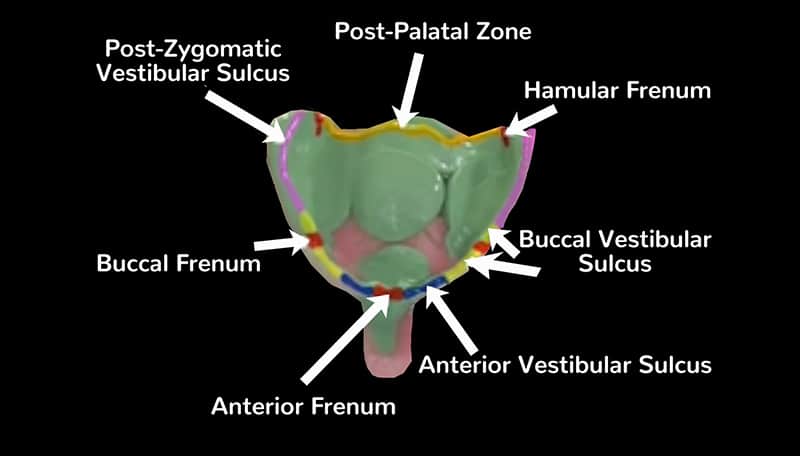 Techniques for getting a correct dental impression