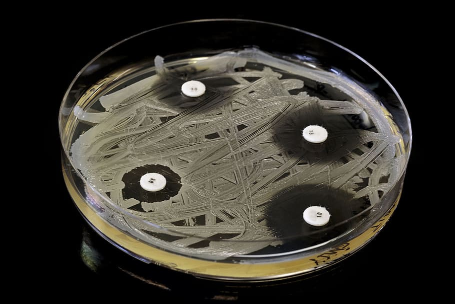 Testing different concentrations of antibiotics, infection, microorganisms, HD wallpaper