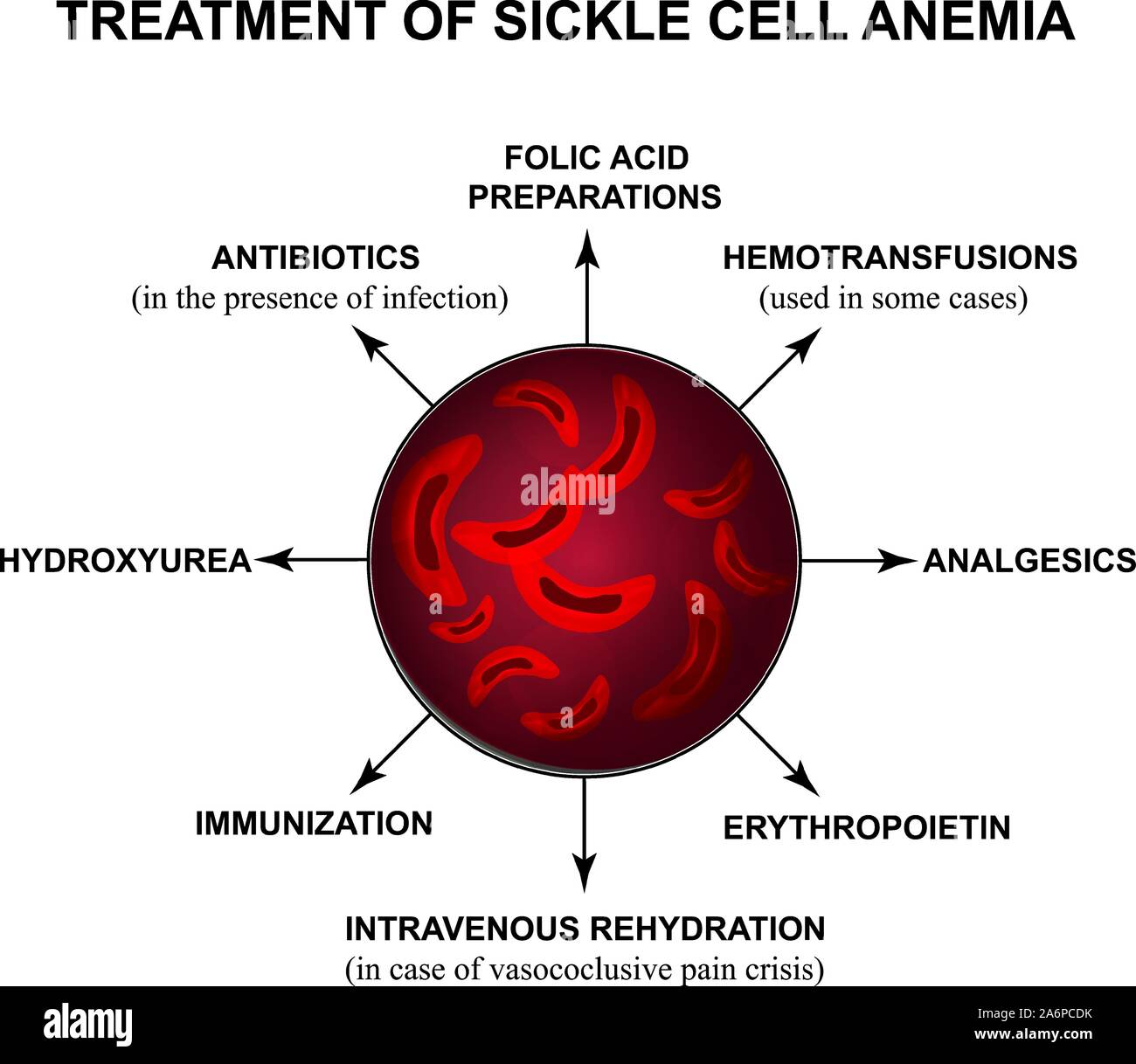 Sickle Cell Anemia Chart