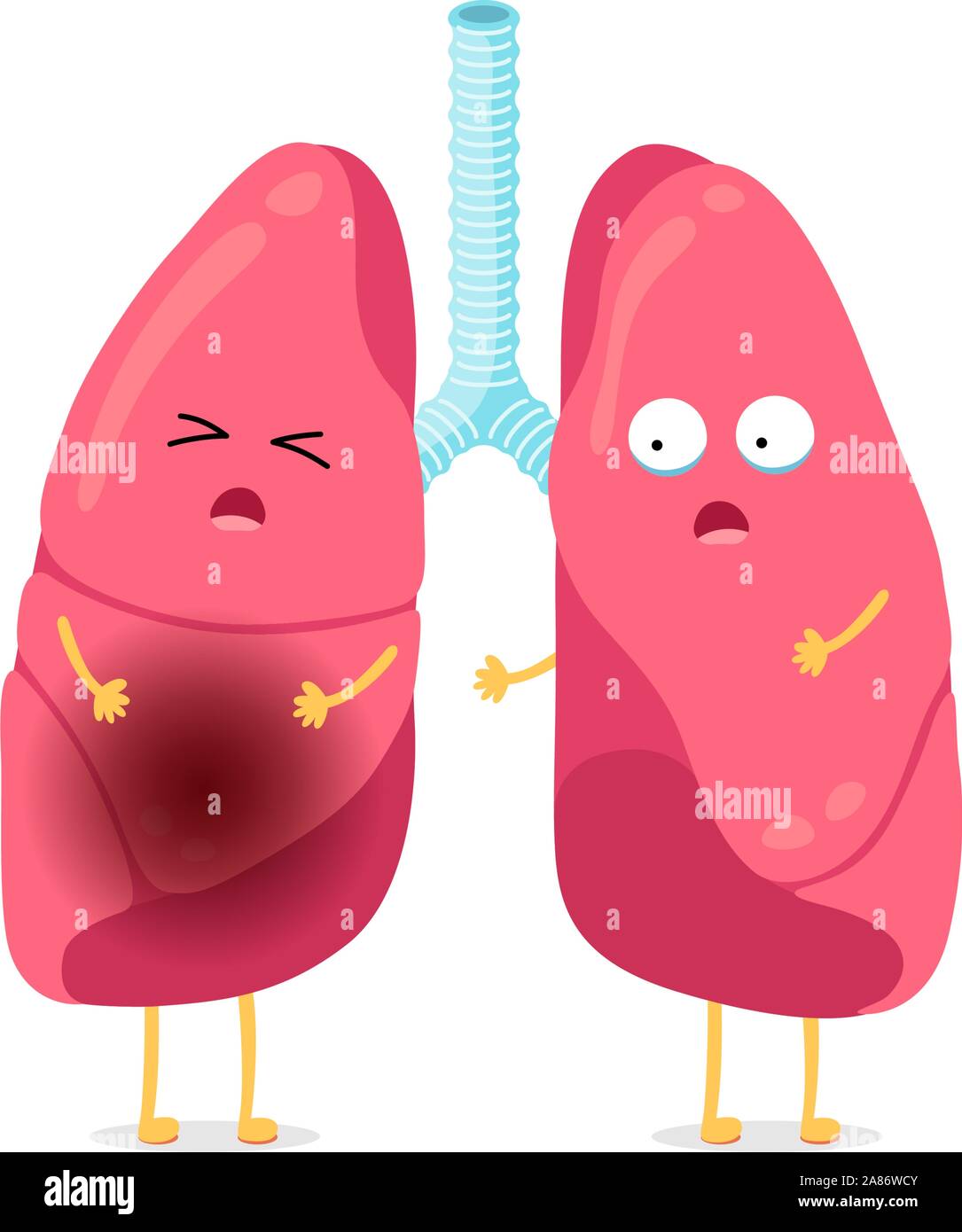 Top 186 + Inflammation medical animation - Lestwinsonline.com