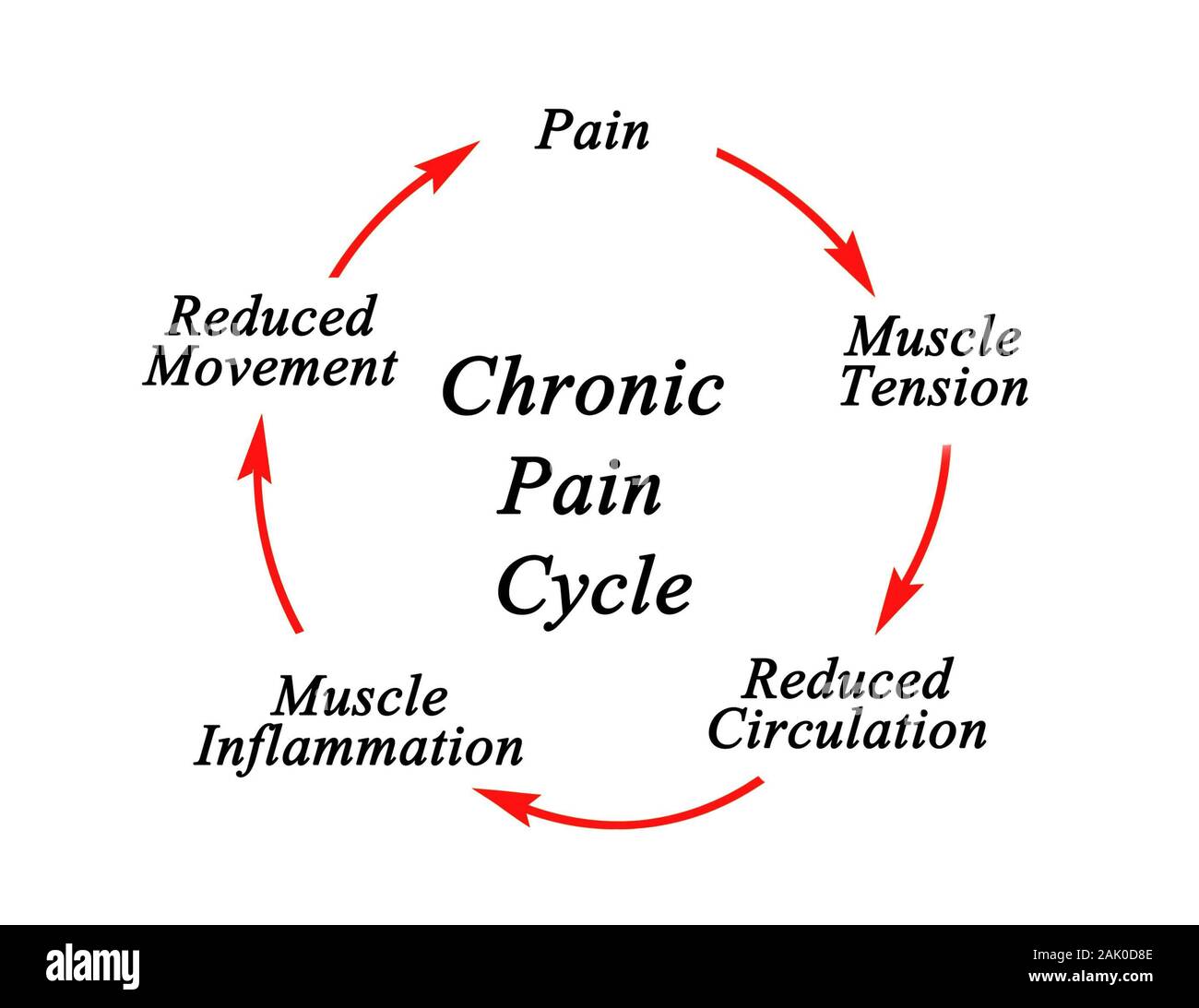 Steps in Chronic Pain Cycle Stock Photo