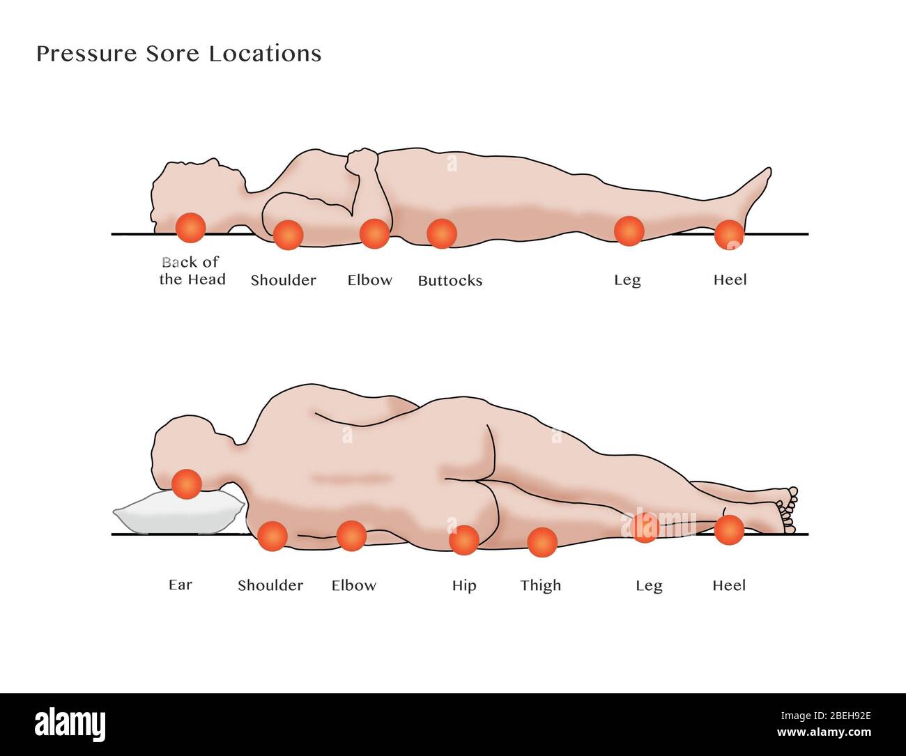 Pressure sore bed Cut Out Stock Images & Pictures - Alamy