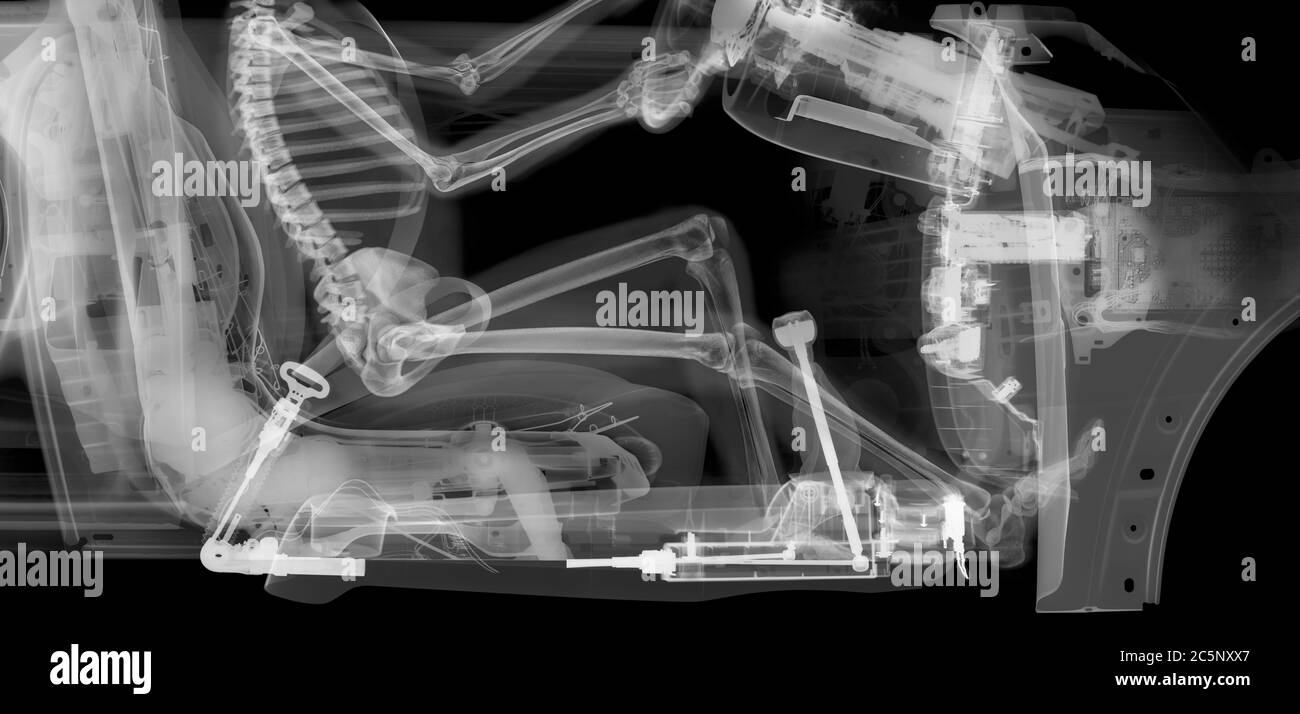 Crop of skeleton driver in car, X-ray. Stock Photo