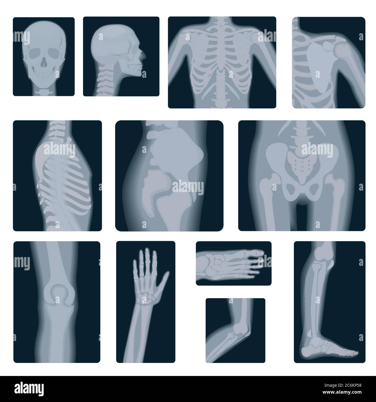 Extreme quality realistic vector collage set of many X-rays shots. X-ray multiple part of adult people Stock Vector