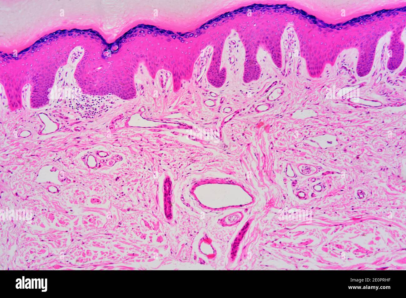 Stratified Squamous Epithelium Keratinized Scalp