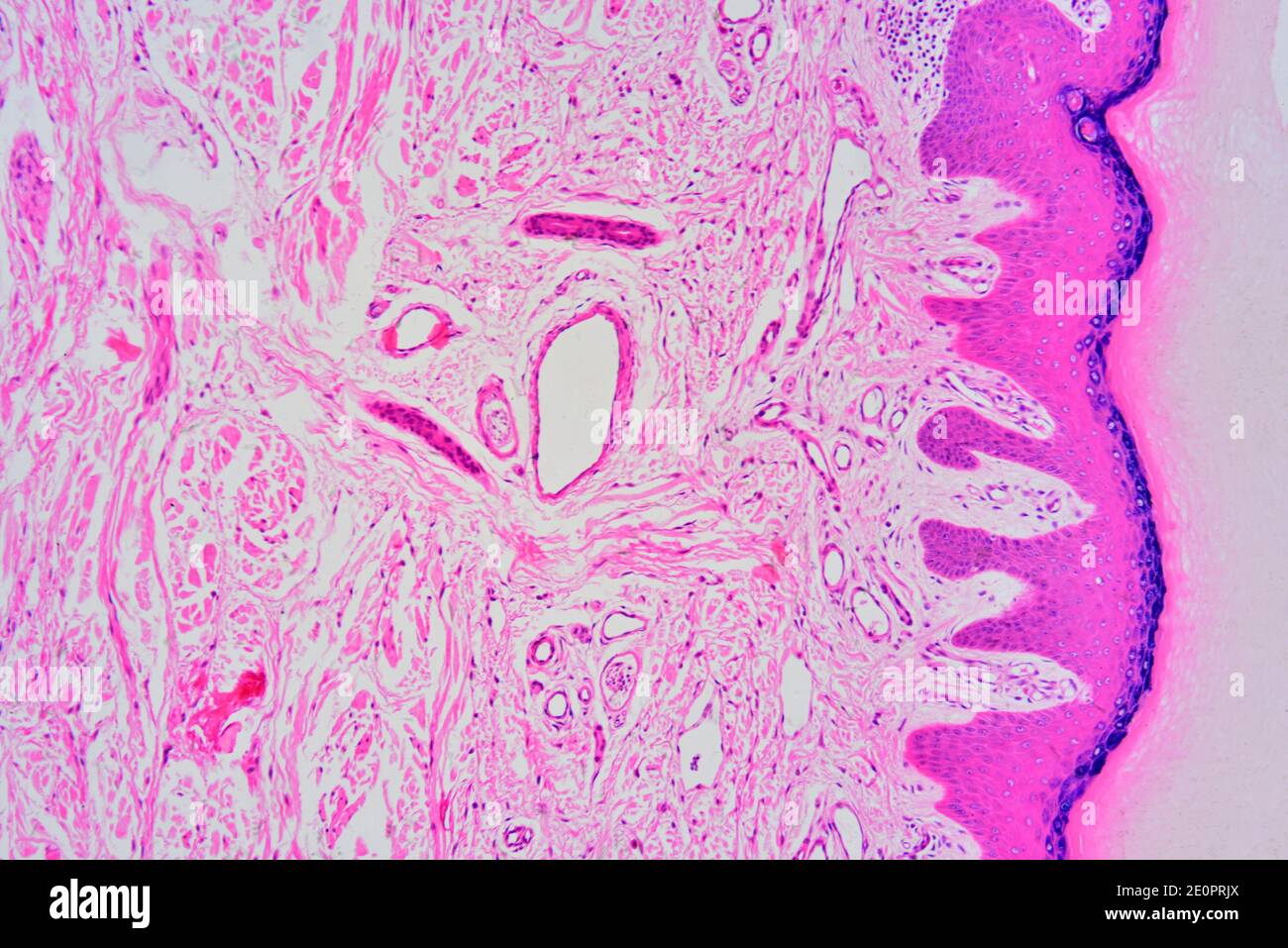 Dermal Papillae