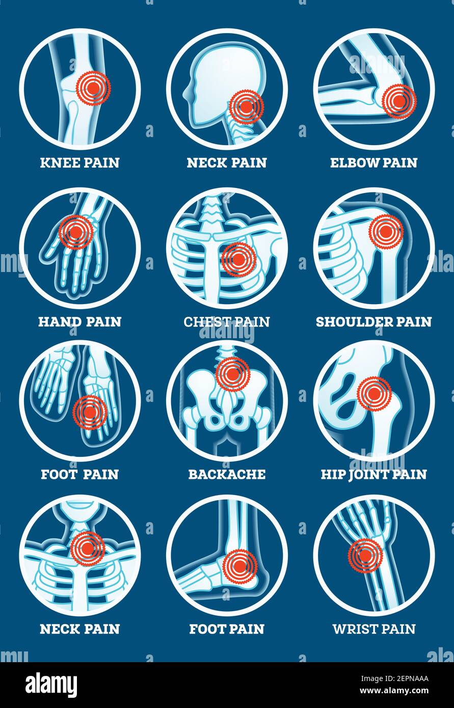 Body Pain Set. Pain in Backache, Hip Joint, Knee, Elbow, Hand, Foot, Shoulder, Neck, Chest and Wrist. Woman's and Man's Body Parts. Vector. Stock Vector