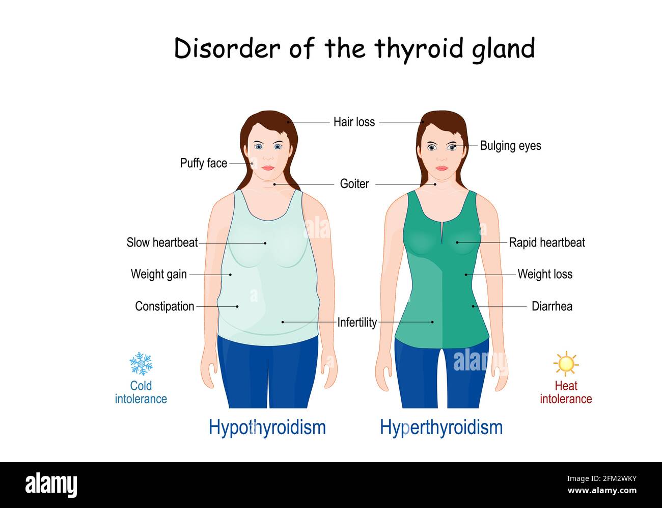 Hyperthyroidism Vs Hypothyroidism