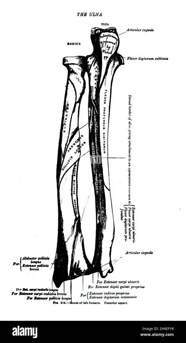 Blak Ulna Bone Diagram