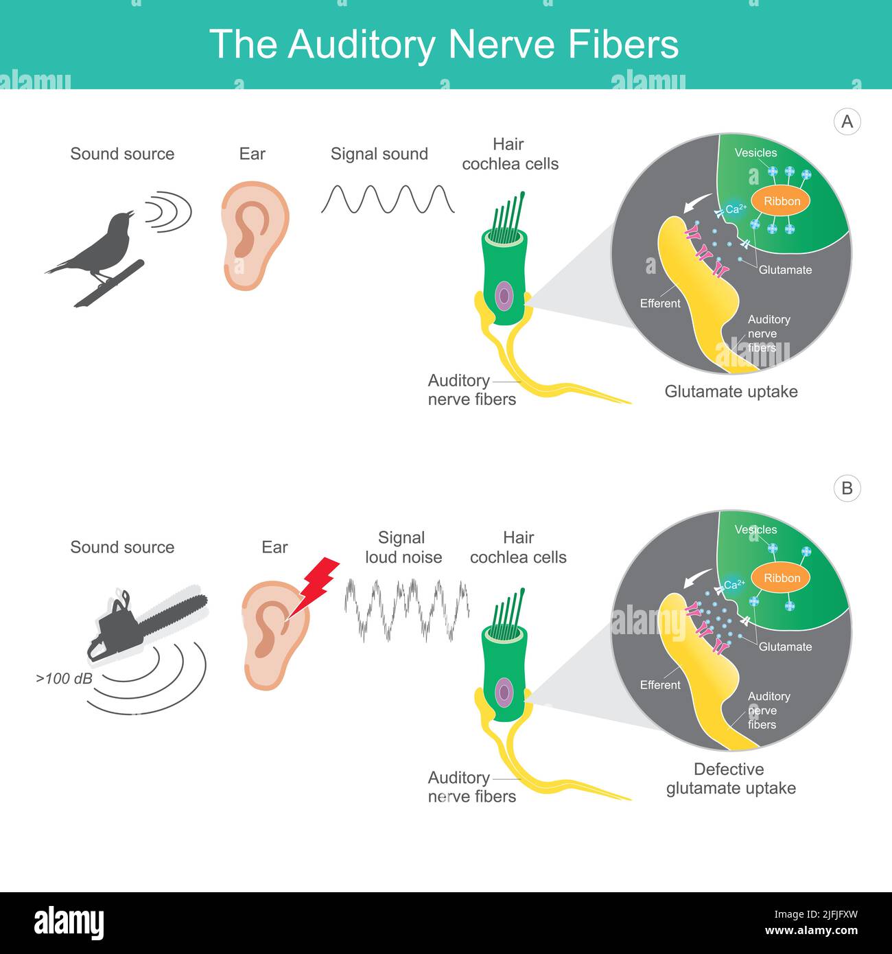 The auditory nerve fibres, comparison sound source 2 types which it is sent the signal sound to the auditory nerve fibres affecting the human brain. Stock Vector