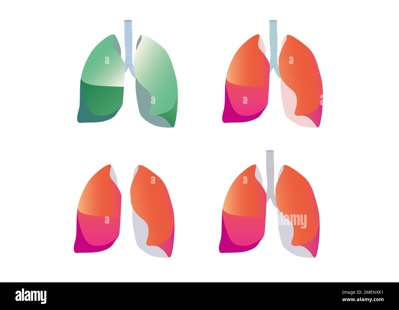 Lungs diagram hi-res stock photography and images - Alamy