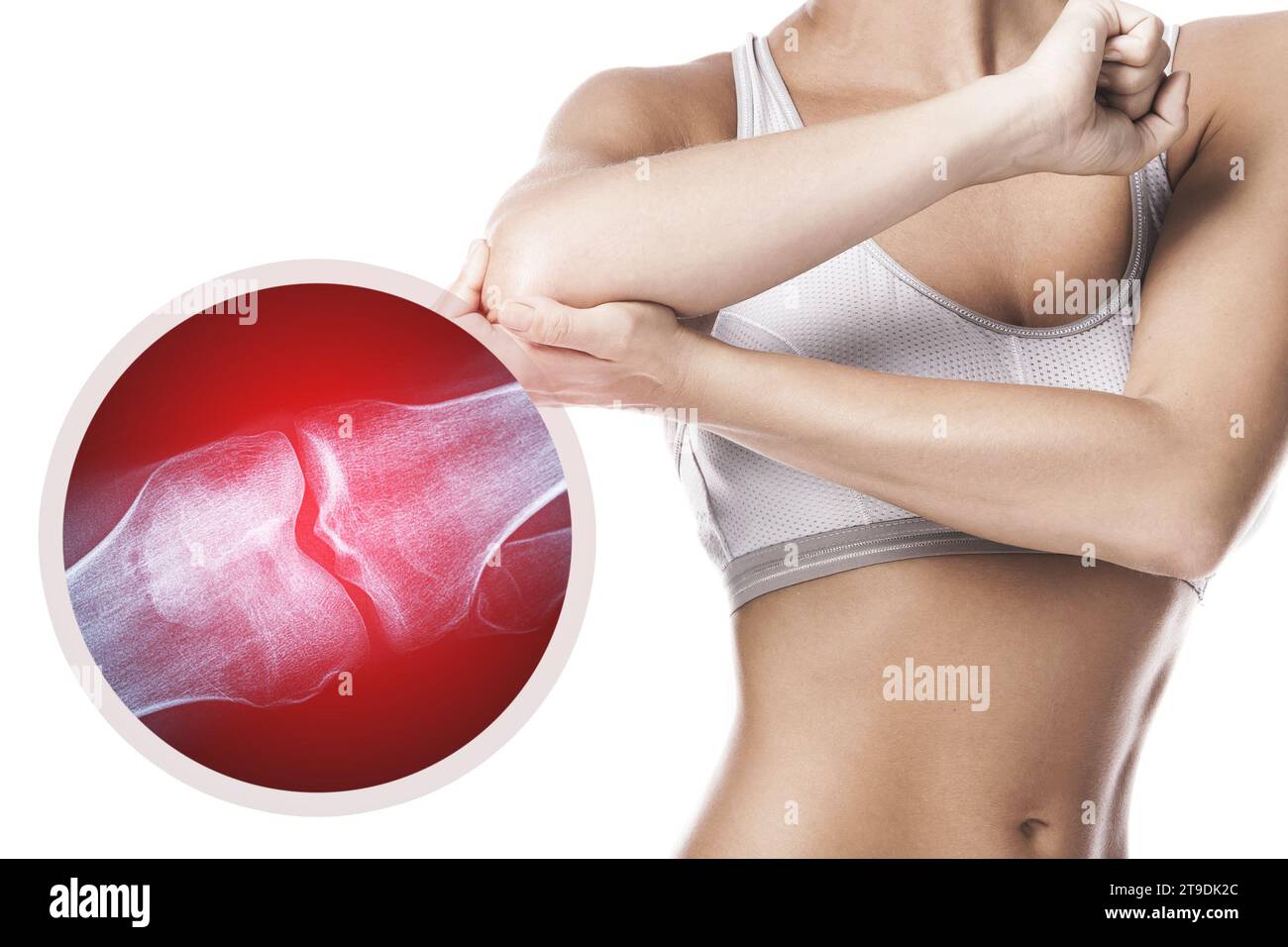 Female elbow and and X-ray effect with an injured joint Stock Photo