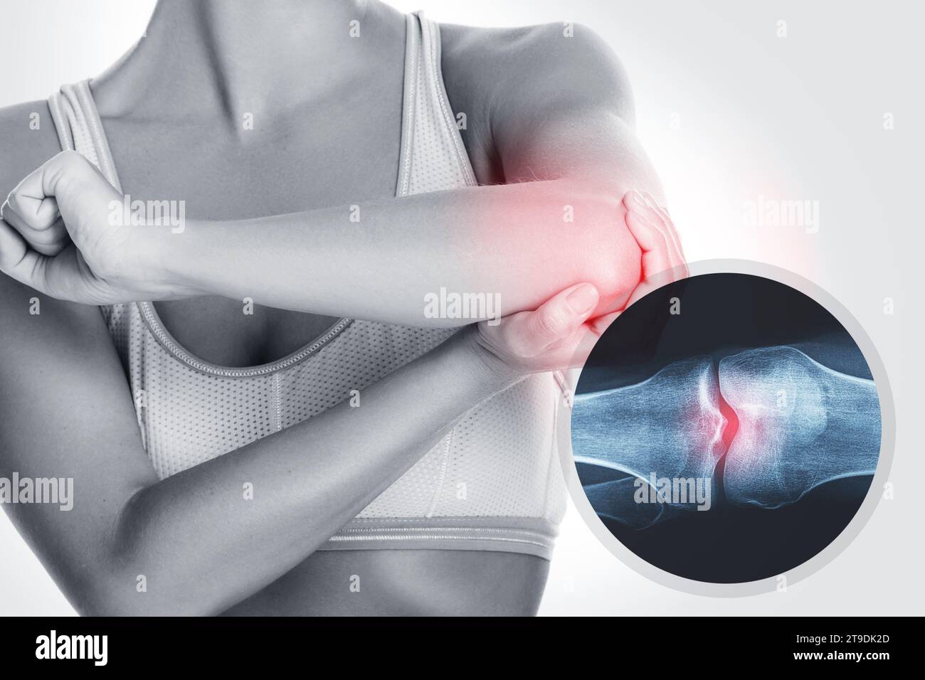 Female elbow and and X-ray effect with an injured joint Stock Photo