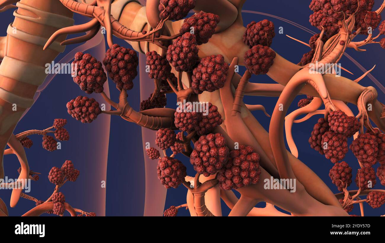 Alveoli in Lungs Facilitating Respiration and Oxygenation Stock Photo