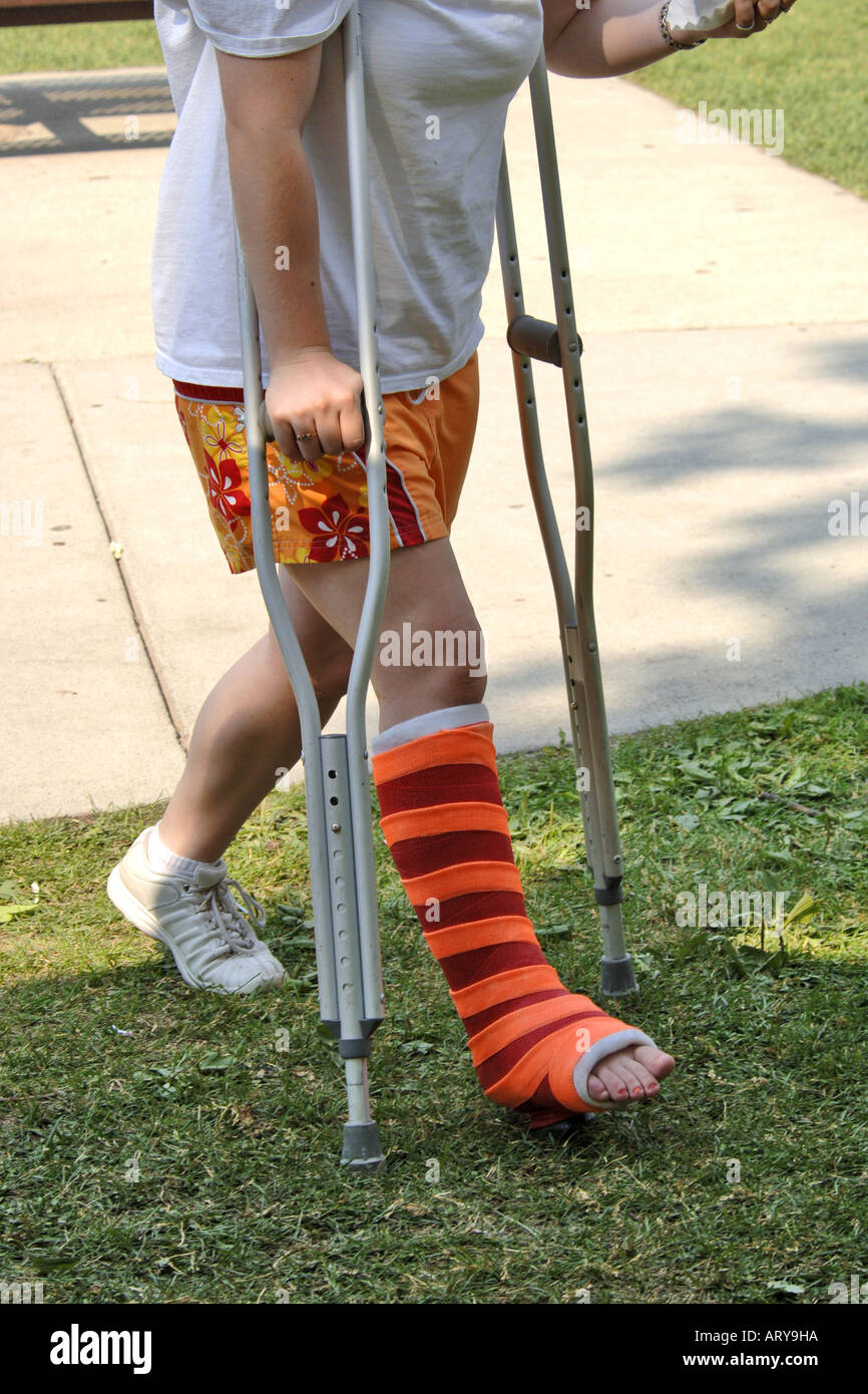 Teenage female with a broken ankle walking on crutches. Stock Photo