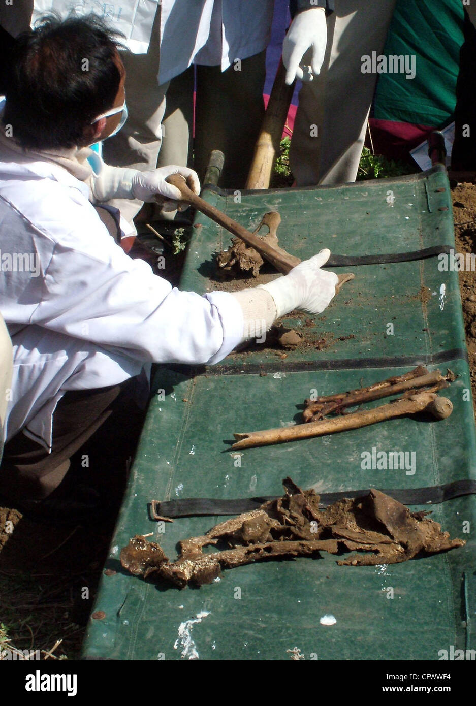 Paramedics examine the remains of a body after it was exhumed from a grave for identification in Srinagar March 10, 2007. The mother of a missing policewoman accused members of Special Operations Group of killing her daughter and Srinagar's Deputy Commissioner ordered the exhumation. PHOTO/ALTAF ZAR Stock Photo