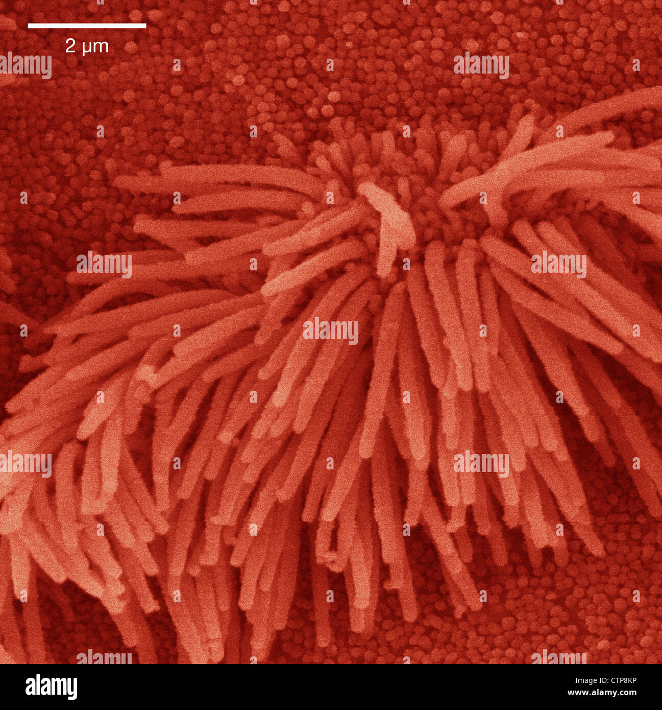 Scanning electron microscope image of lung trachea epithelium Stock Photo