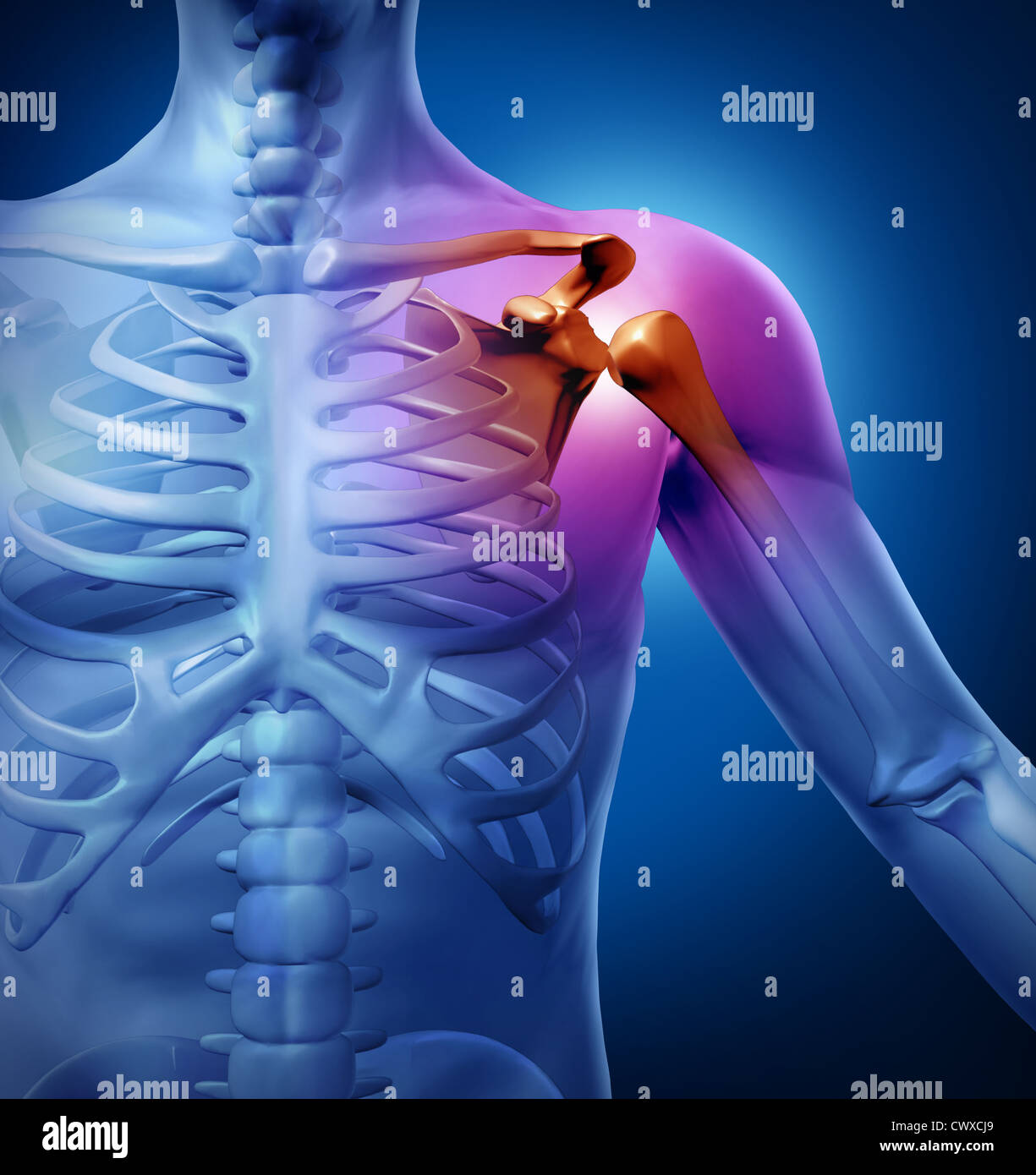 Human shoulder pain with an anatomy injury caused by sports accident or ...