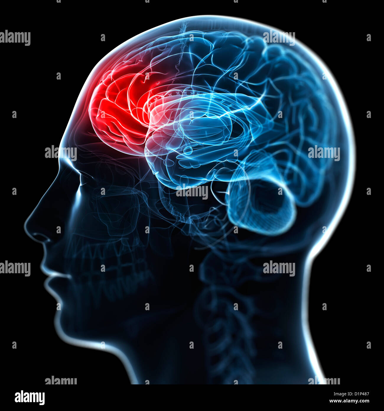 Migraine brain hi-res stock photography and images - Alamy