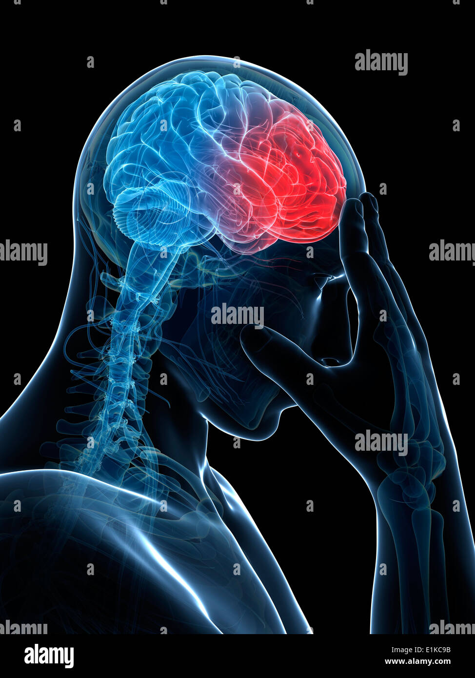 Headache computer artwork Stock Photo - Alamy