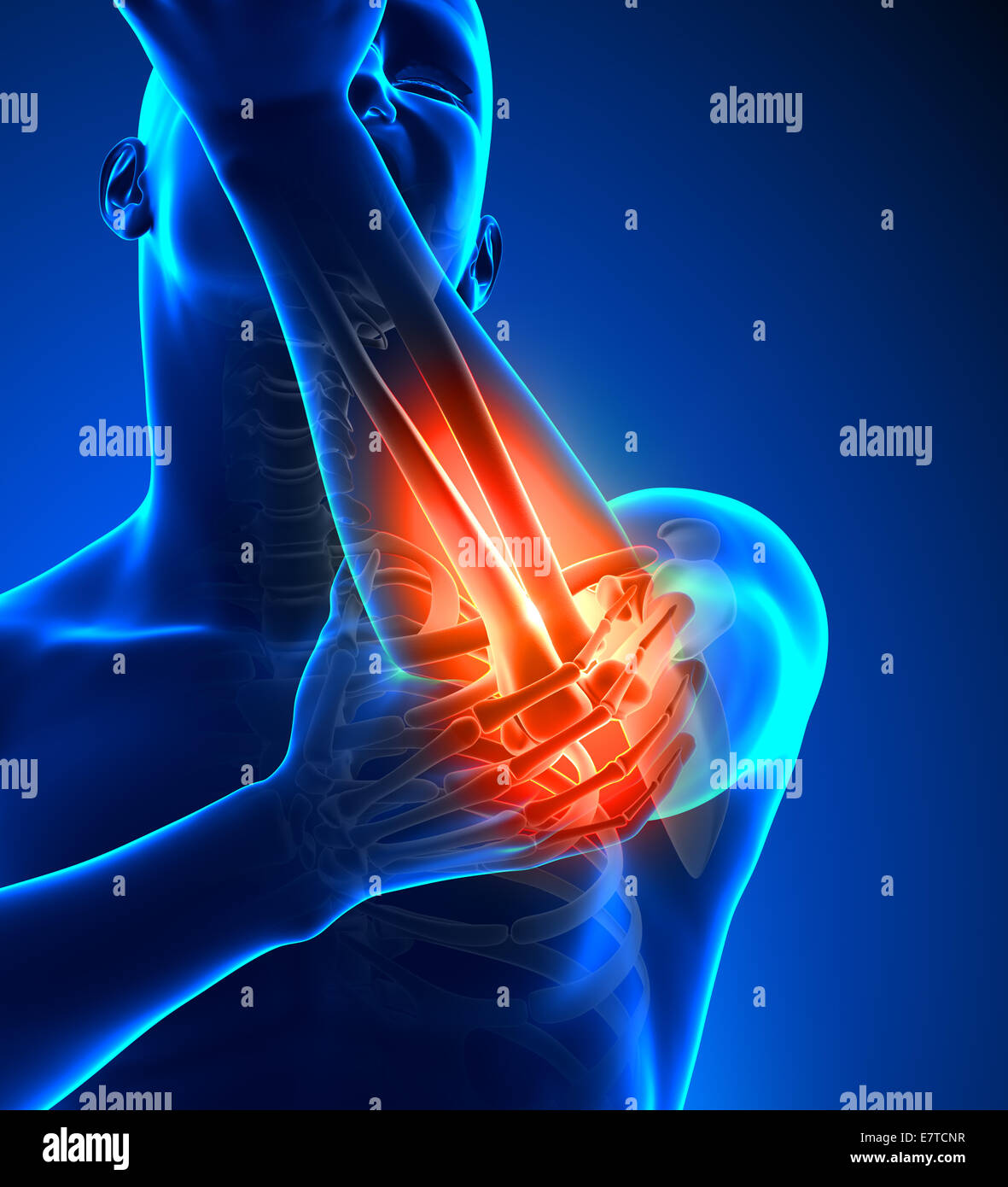 Elbow Pain Male - Front view Stock Photo