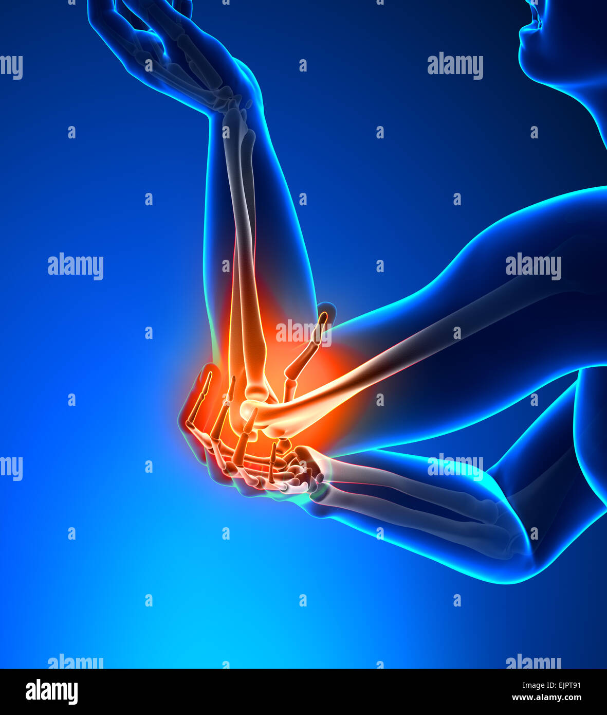 Elbow Pain Male - Side view Stock Photo