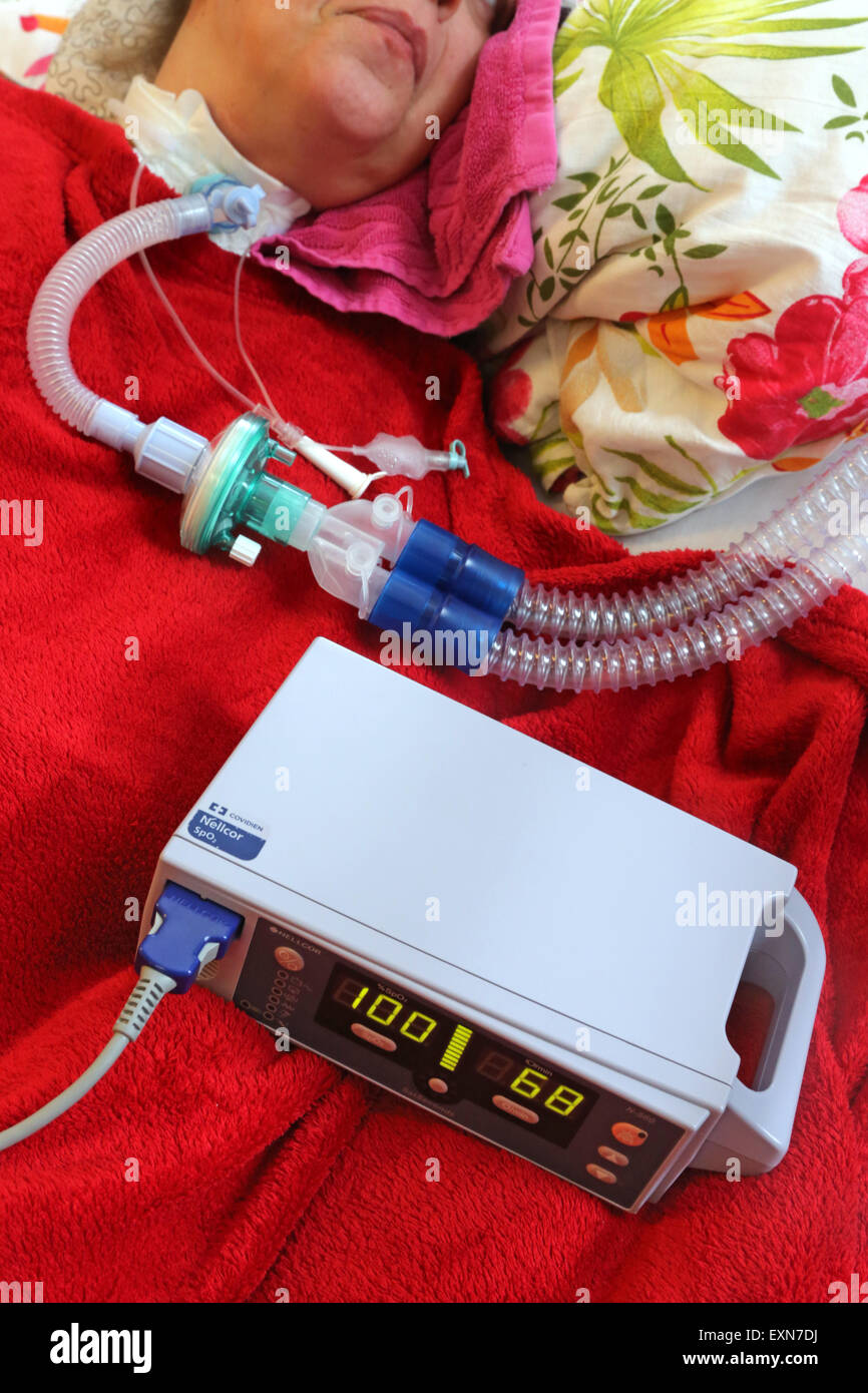 Patient who needs artificial respiration is monitored by a pulse oxymeter in a care center in Essen / Germany Stock Photo