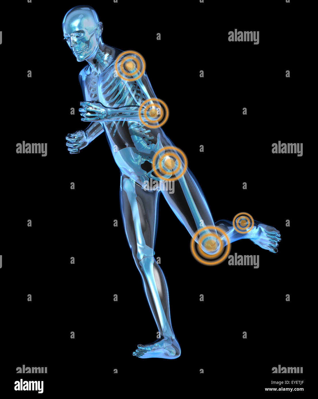 Radiograph of a human body in the act of running with hip pain, knee, elbow and shoulder Stock Photo